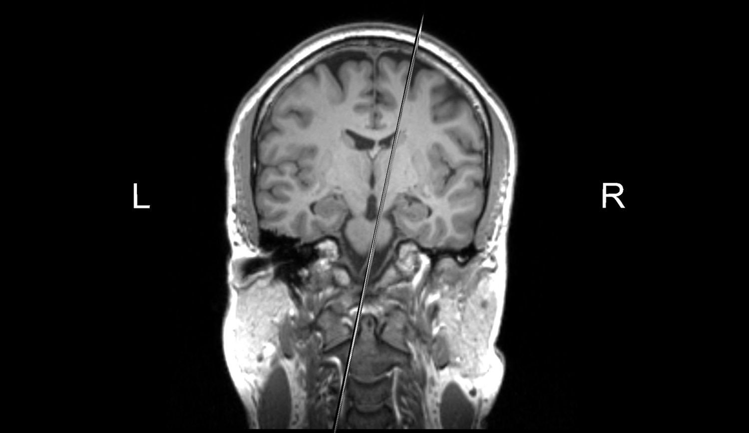 An MRI Scan