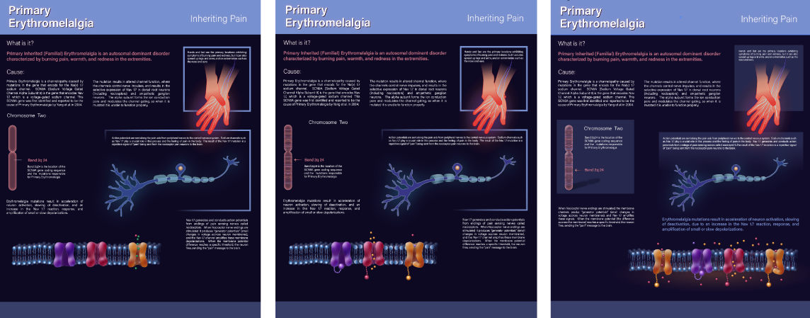 Work in progress of an educational poster design with scientific illustrations depicting a medical condition called Erythromelalgia