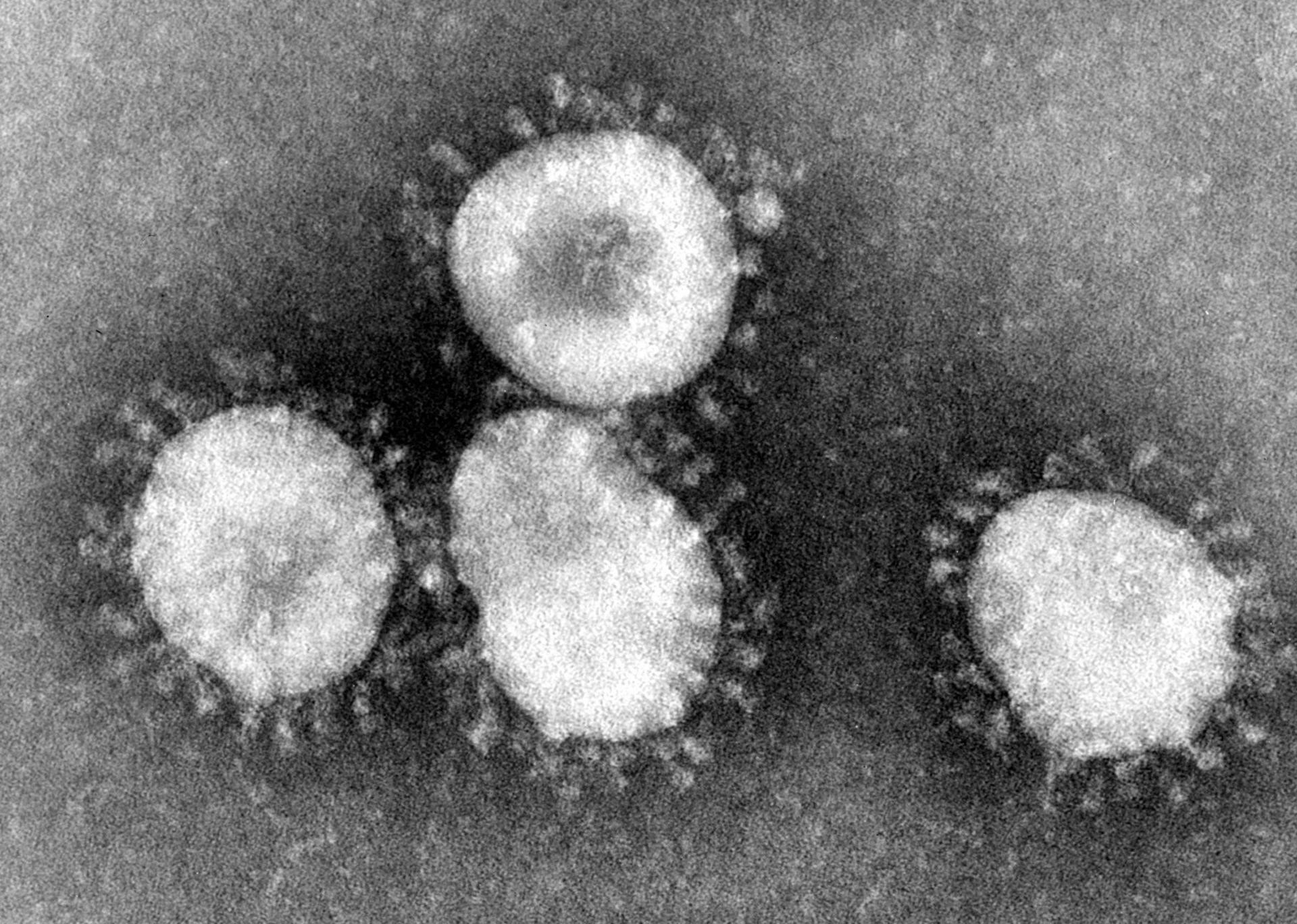Coronavirus RNA microscope image