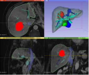 Colorful scans of organs for 3D printing