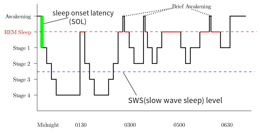 This graph shows the phases of sleep across an entire night in an example individual, starting from being awake and going into Stage 1, 2, 3, 4, then REM sleep. Stages 3 and 4 constitute slow wave sleep.