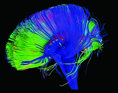 Individual strands of white matter are visible, with all the gray matter removed. Strings of white matter are color coded such that sections running top to bottom (ie: down the spinal cord) are blue, sections going from one hemisphere to the other are red, and other sections are green.