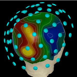 A human head is shown with individual MEG magnetometers around it. The back of the brain appears red and yellow, indicating higher activity, while the side of the front of the brain appears blue, indicating lower activity.