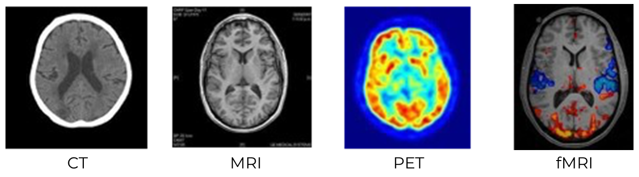 All images show a horizontal cross section of a brain. The CT image appears fuzzy and gray, with poor definition between different brain structures. The MRI image is black and white with clear sharp distinction between gray and white matter. The PET image is very colorful, with every aspect of the brain appearing on a spectrum from red to blue. The fMRI image is similar to the MRI image but with added sections of red or blue over top of the gray structures.