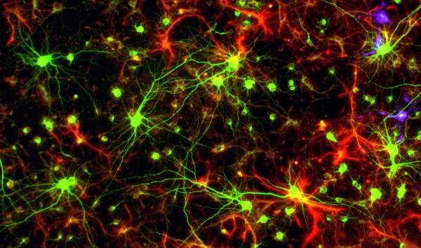Glial Cells and Neurons