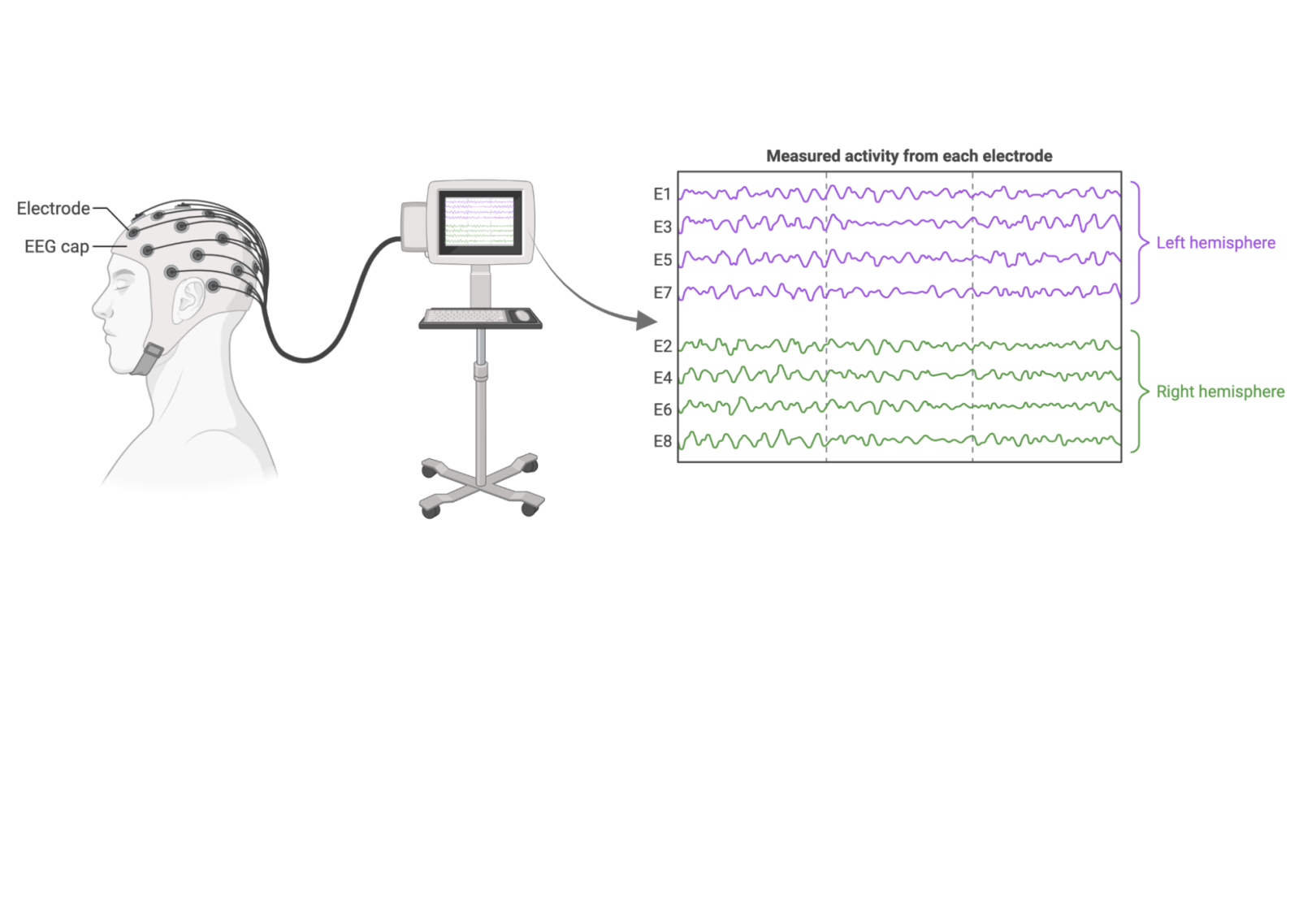 A human head wearing an EEG cap covered in electrodes is shown, hooked up to a computer. The computer screen is zoomed in so that the electrical activity from each electrode is visible on screen.
